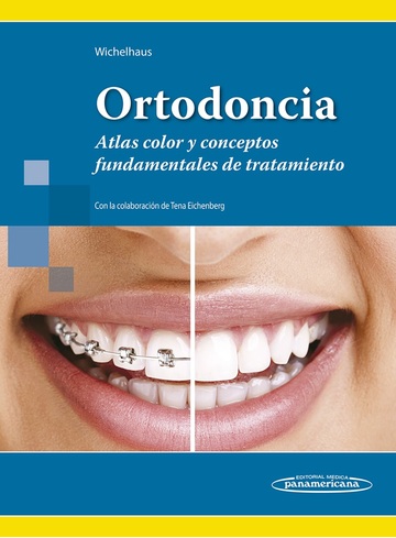 Ortodoncia. Atlas color y conceptos fundamentales de tratamiento.