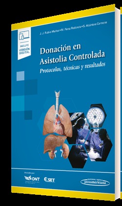Donacin en Asistolia Controlada