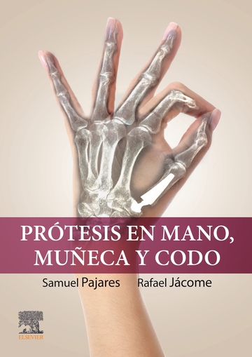 Prtesis en mano, mueca y codo