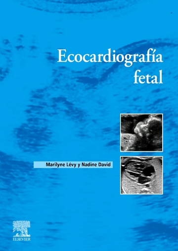 Ecocardiografa fetal