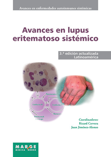 Avances en lupus eritematoso sistmico - Latinoamrica
