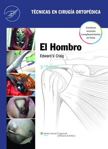 Tcnicas en Ciruga Ortopdica. El Hombro