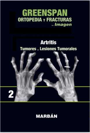 Ortopedia Y Fracturas En Imagenes (vol 2): Artritis. Tumores.