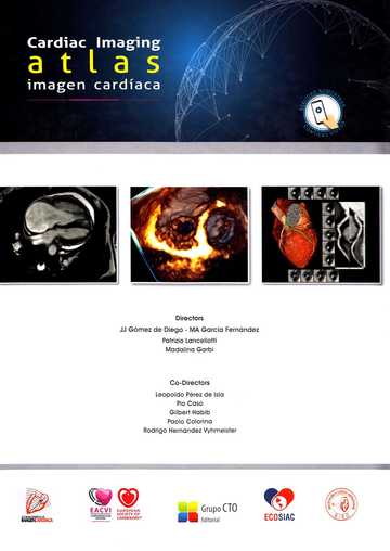 Atlas de Imagen Cardaca-Cardiac Imaging Atlas