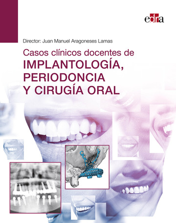 Casos clnicos docentes de implantologa, periodoncia y ciruga oral