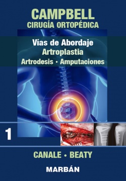 Campbell - Ciruga Ortopdica Tomo 1: Vas de abordaje,m Artroplastia, Artrodesis, Amputaciones
