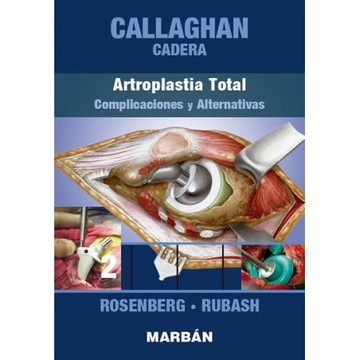 Callaghan Cadera. Tomo 2 Artroplastia Total, Complicaciones y Alternativas