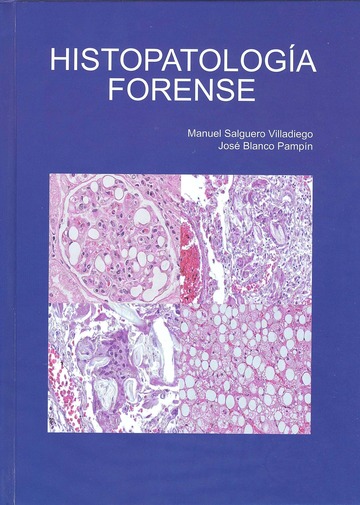 Histopatologa forense