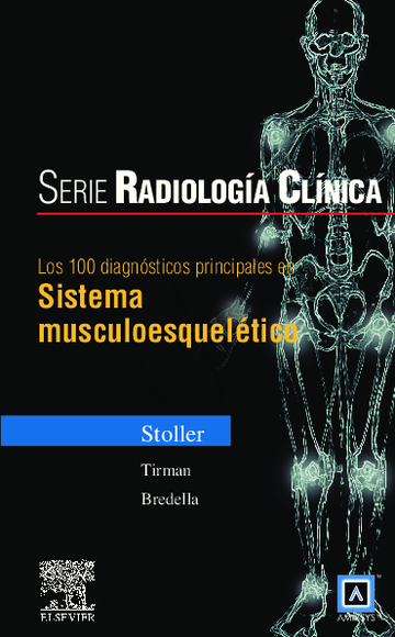 Serie Radiologa Clnica: Los 100 Diagnsticos Principales En Sistema Musculoesq 