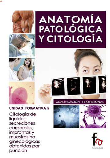 Citologia de liquidos , secreciones corporales, improntas y muestras no gineclogicas obtenidas por puncin