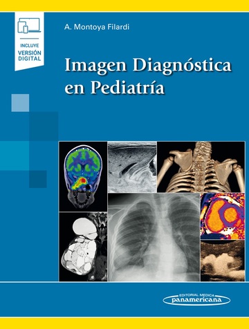 Imagen Diagnstica en Pediatra (incluye versin digital)
