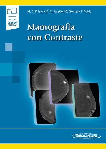 Mamografa con Contraste (+e-book)