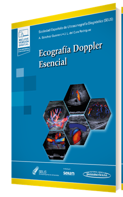 Ecografa Doppler Esencial (+e-book)