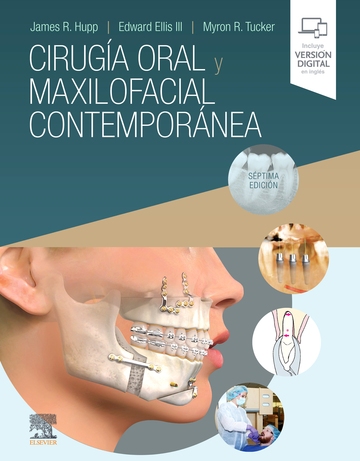Ciruga oral y maxilofacial contempornea (7 ed.)