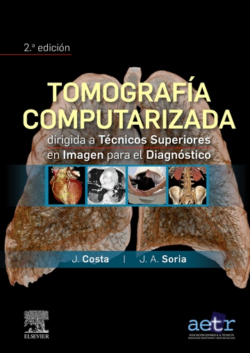 Tomografa computarizada dirigida a tcnicos superiores en imagen para el diagnstico