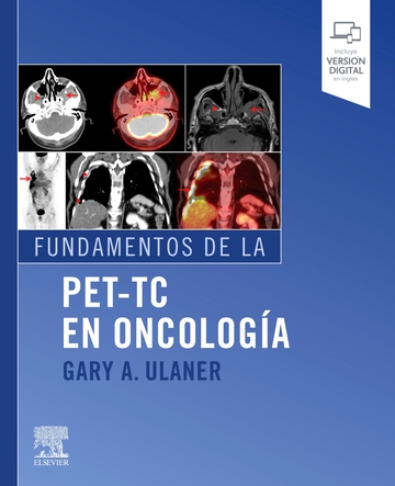 Fundamentos de la PET-TC en oncologa