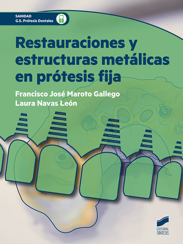 Restauraciones y estructuras metlicas en prtesis fija