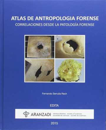 Atlas de antropologa forense