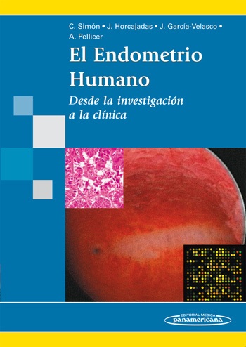 Endometrio Humano , desde la investigacin a la clnica