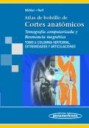 Atlas de Bolsillo de Cortes Anatmicos , Tomografa computarizada y Resonancia magntica Tomo 3 : Columna Vertebral , Extremidad