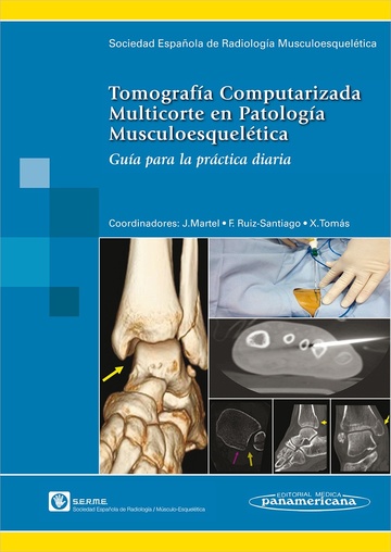 Tomografa Computarizada Multicorte en Patologa Musculoesqueltica