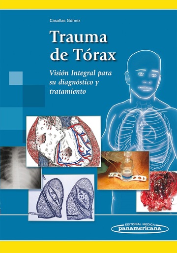 Trauma de Trax
